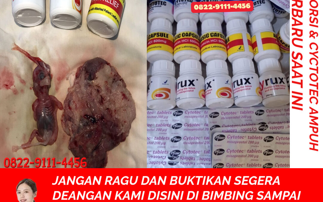 Cara Menggugurkan Kandungan yang Masih Hitungan Hari dan Minim Efek Samping