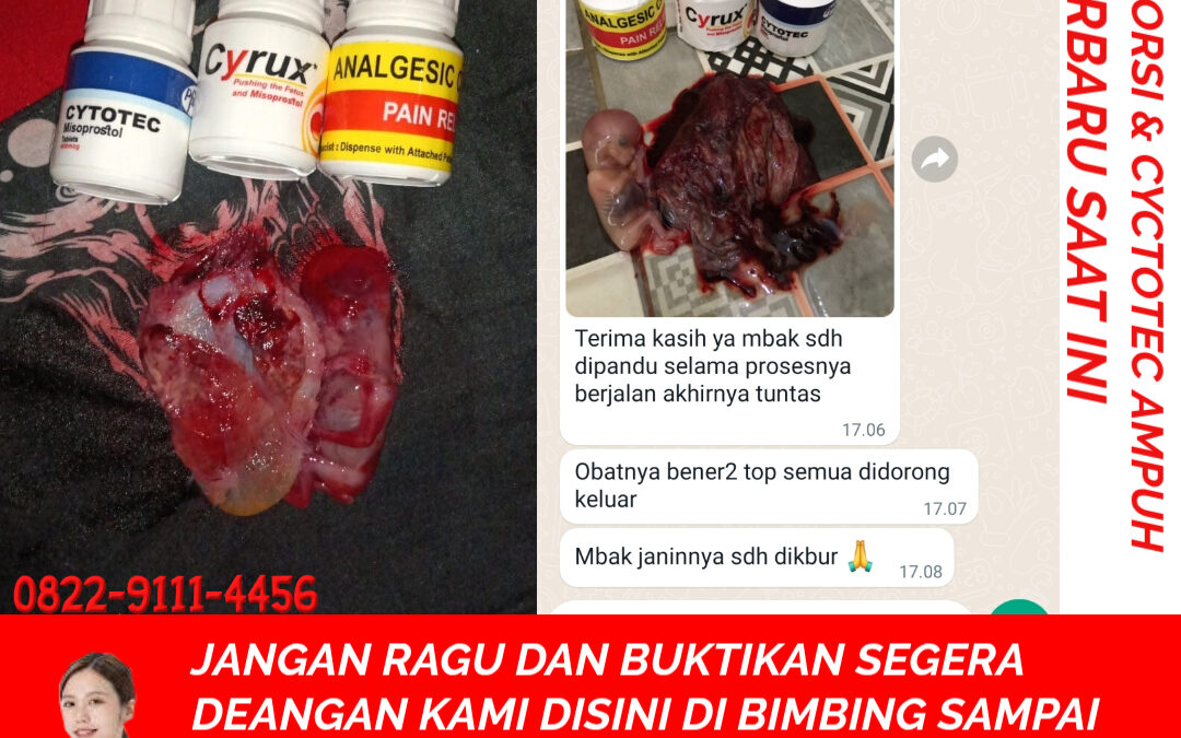 Cara Cepat Menggugurkan Kandungan 082291114456 Obat Aborsi Cytotec Usia Kehamilan 1 – 8 Bulan